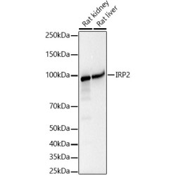 IRP2 Rabbit mAb