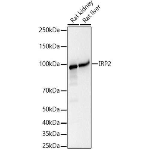 IRP2 Rabbit mAb