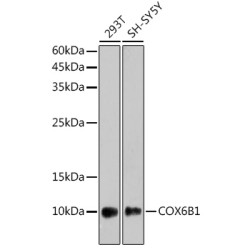 COX6B1 Rabbit mAb