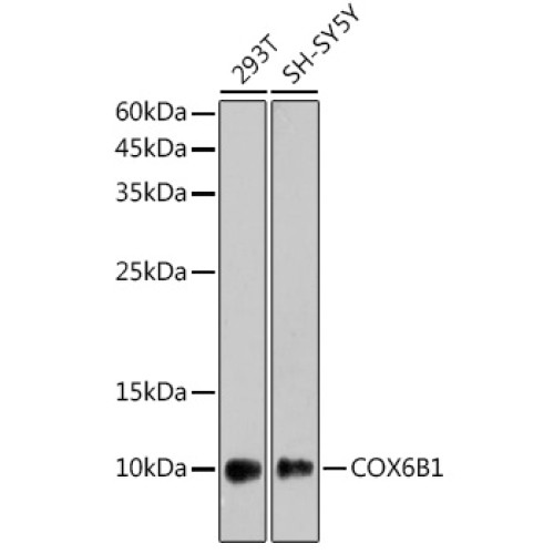 COX6B1 Rabbit mAb