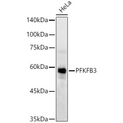 PFKFB3 Rabbit mAb