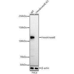 [KO Validated] Hexokinase II Rabbit mAb