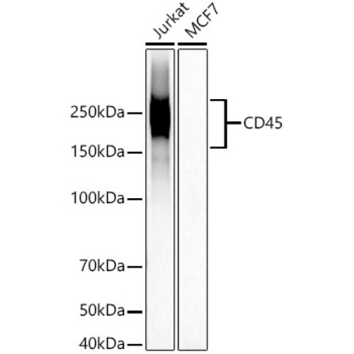 CD45 Rabbit mAb