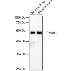 [KO Validated] Smad1 Rabbit mAb