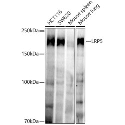 LRP5 Rabbit mAb