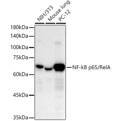 [KO Validated] NF-kB p65/RelA Rabbit mAb