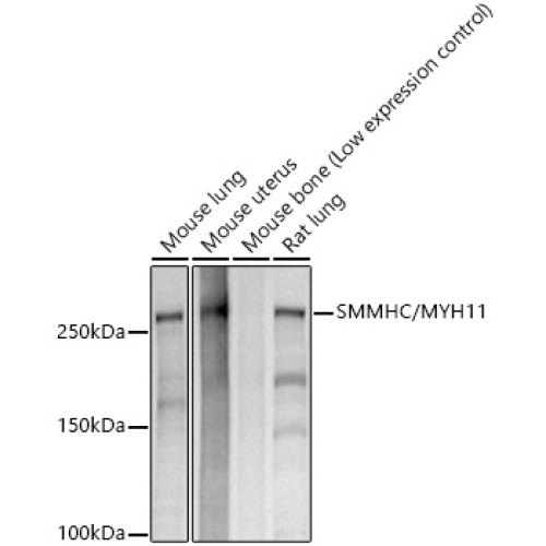 SMMHC/MYH11 Rabbit mAb