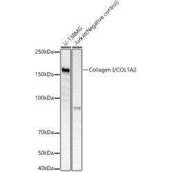 Collagen I/COL1A2 Rabbit mAb