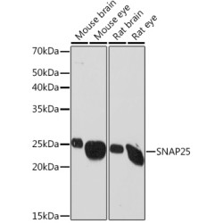 SNAP25 Rabbit mAb