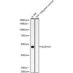 ALDH1A1 Rabbit mAb