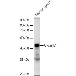 Cyclin E1 Rabbit mAb