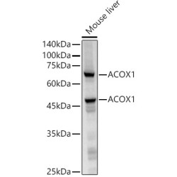 ACOX1 Rabbit mAb
