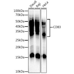 CD83 Rabbit mAb