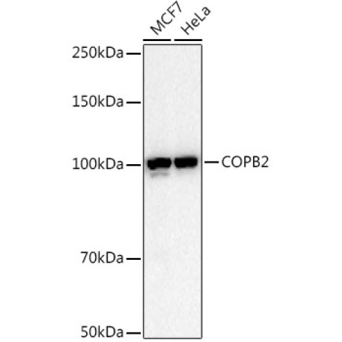 COPB2 Rabbit mAb