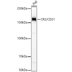 CR2/CD21 Rabbit mAb