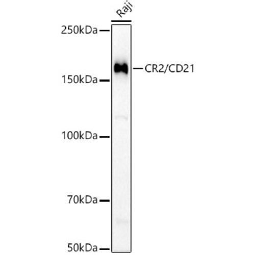 CR2/CD21 Rabbit mAb