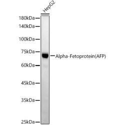 Alpha-Fetoprotein (AFP) Rabbit mAb