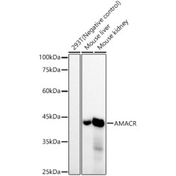 AMACR/p504S Rabbit mAb