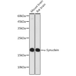 α-Synuclein Rabbit mAb