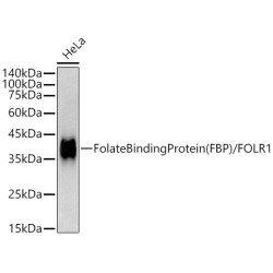 Folate Binding Protein(FBP) / FOLR1 Rabbit mAb
