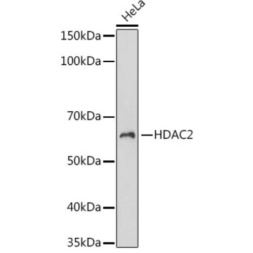 HDAC2 Rabbit mAb