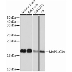 MAP1LC3A Rabbit mAb