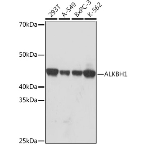 ALKBH1 Rabbit mAb