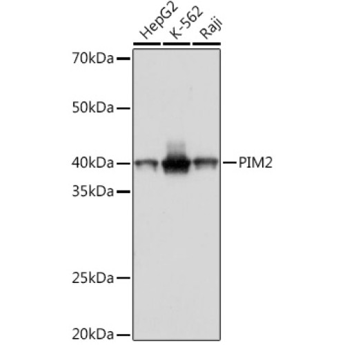 PIM2 Rabbit mAb