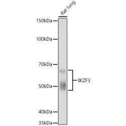 IKZF3 Rabbit mAb