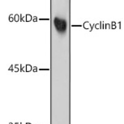Cyclin B1 Rabbit mAb