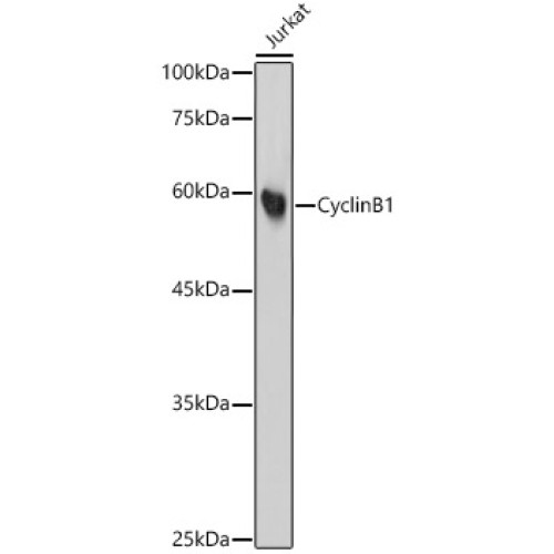 Cyclin B1 Rabbit mAb