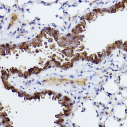 Caspase-6 Rabbit mAb