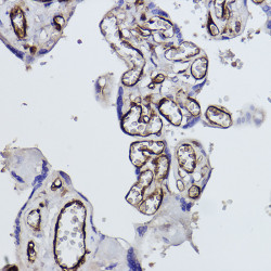 Tryptophanyl-tRNA synthetase 1 Rabbit mAb