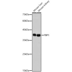FBP1 Rabbit mAb