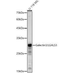 Galectin 3/LGALS3 Rabbit mAb