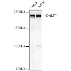 DNMT1 Rabbit mAb