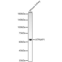 ATP6AP1 Rabbit mAb
