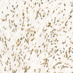 CDK12 Rabbit mAb