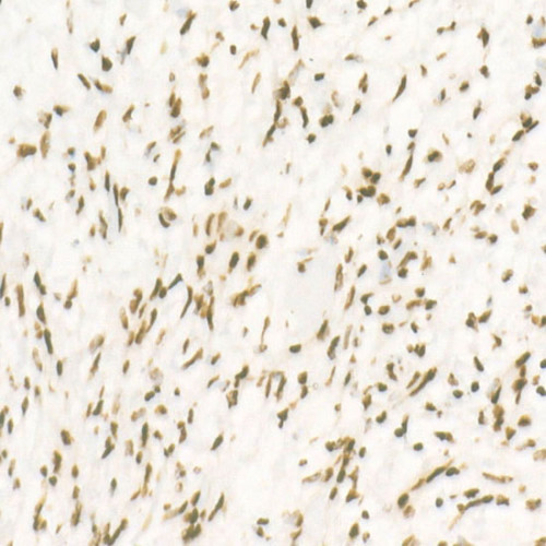 CDK12 Rabbit mAb
