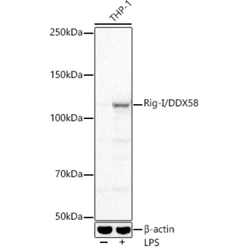 Rig-I/DDX58 Rabbit mAb