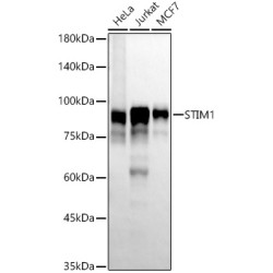 STIM1 Rabbit mAb