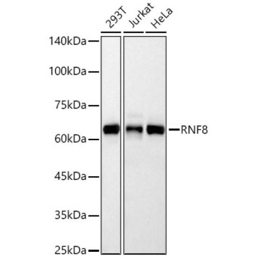 RNF8 Rabbit mAb