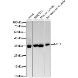 [KO Validated] MCU Rabbit mAb