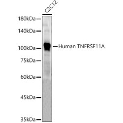 Human TNFRSF11A Rabbit pAb