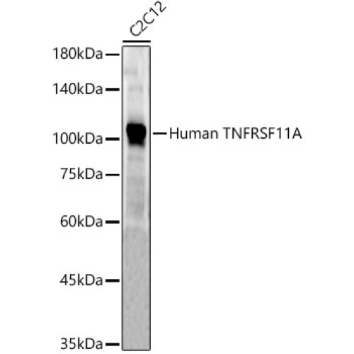 Human TNFRSF11A Rabbit pAb
