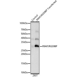 R9AP/RGS9BP Rabbit pAb