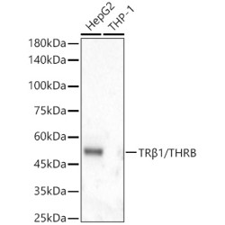 TRβ1/THRB Rabbit mAb