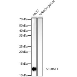 S100A11 Rabbit mAb