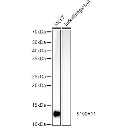 S100A11 Rabbit mAb