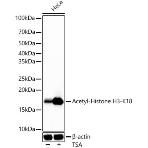 Acetyl-Histone H3-K18 Rabbit mAb